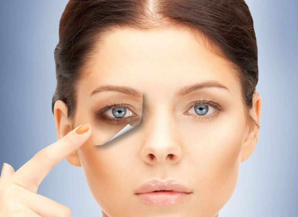 11 ماده فوق العاده موثر برای درمان قطعی سیاهی و تیرگی دور چشم
